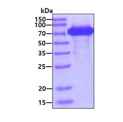 SDS-PAGE: Recombinant Human GRP78/HSPA5 His Protein [NBP1-50908]