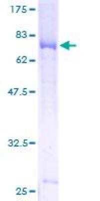 SDS-PAGE: Recombinant Human GSDMDC1 GST (N-Term) Protein [H00079792-P01]