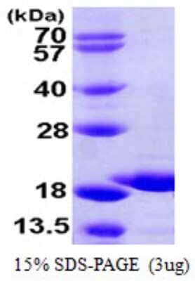 SDS-PAGE: Recombinant Human GSKIP His Protein [NBP1-51075]