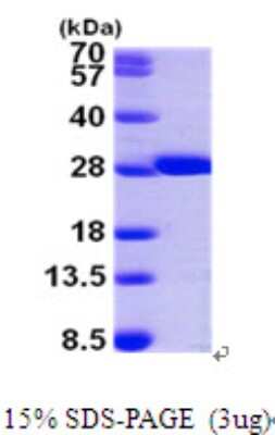 SDS-PAGE: Recombinant Human GSTM2 His Protein [NBP1-50850]