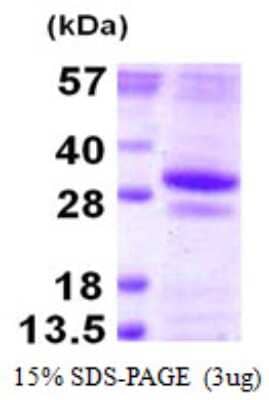 SDS-PAGE: Recombinant Human GSTO2 His Protein [NBP1-99012]