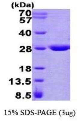 SDS-PAGE: Recombinant Human GSTZ1 His Protein [NBP1-40410]