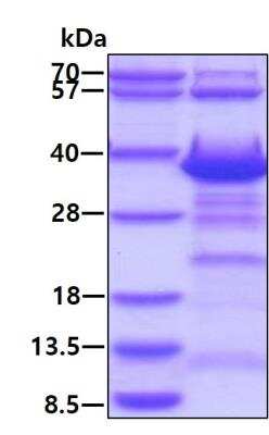 SDS-PAGE: Recombinant Human GTF2A1 His Protein [NBP2-23074]