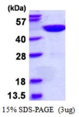 SDS-PAGE: Recombinant Human GTPBP9 His Protein [NBP1-98872]