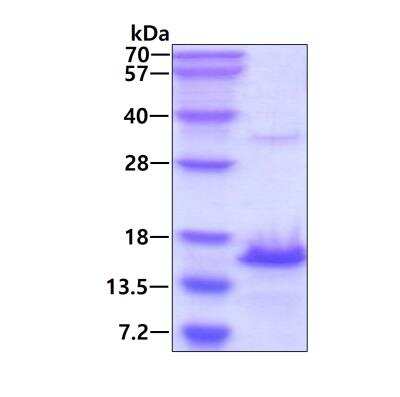 SDS-PAGE: Recombinant Human Galanin His Protein [NBP2-23069]