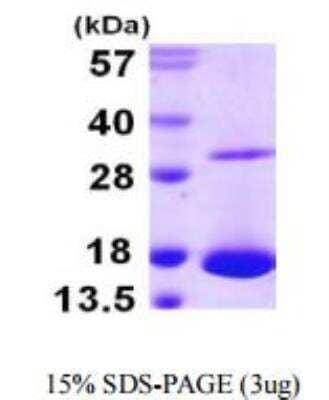 SDS-PAGE: Recombinant Human Galectin-10 His Protein [NBP1-51096]