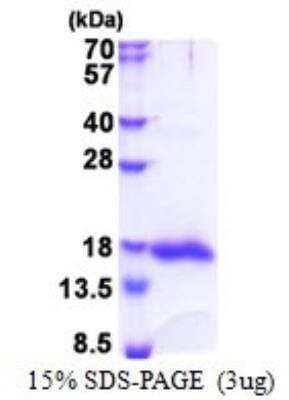 SDS-PAGE: Recombinant Human Galectin 13 His Protein [NBP2-23189]