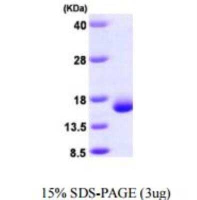 SDS-PAGE: Recombinant Human Galectin-2 His Protein [NBP1-48326]