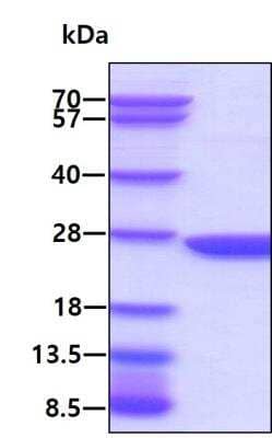 SDS-PAGE: Recombinant Human Gankyrin Protein [NBC1-18518]