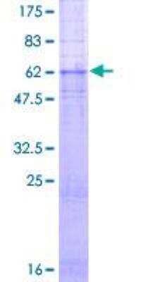 SDS-PAGE: Recombinant Human Gastrin-releasing Peptide R/GRPR GST (N-Term) Protein [H00002925-P01]