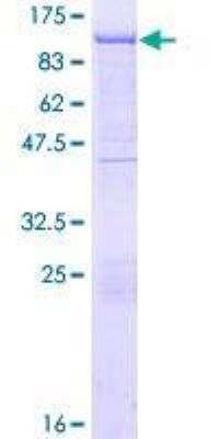 SDS-PAGE: Recombinant Human Gelsolin/GSN GST (N-Term) Protein [H00002934-P01]