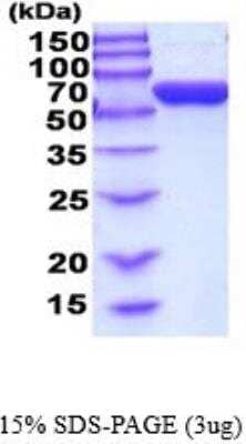 SDS-PAGE: Recombinant Human Glucose 6 phosphate isomerase His Protein [NBP2-52232]