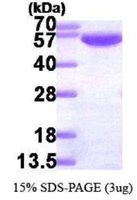 SDS-PAGE: Recombinant Human Glucose 6 phosphate isomerase His Protein [NBP3-07000]