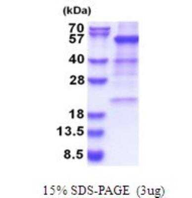 SDS-PAGE: Recombinant Human Glutamate Dehydrogenase His Protein [NBP2-51666]