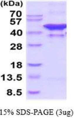 SDS-PAGE: Recombinant Human Glutamine Synthetase His Protein [NBP2-52619]