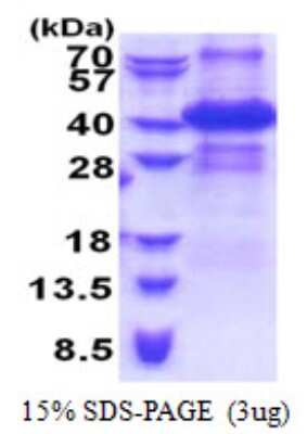 SDS-PAGE: Recombinant Human ING2 His Protein [NBP2-61168]