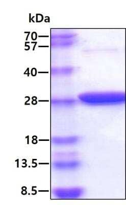 SDS-PAGE: Recombinant Human Glutathione Peroxidase 1/GPX1 His Protein [NBP1-72512]