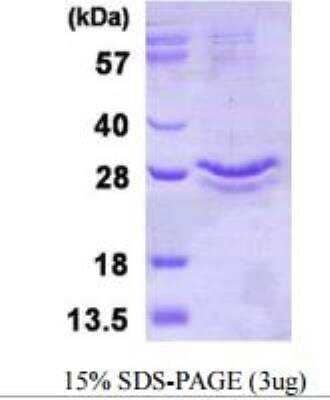 SDS-PAGE: Recombinant Human Glutathione Peroxidase 3/GPX3 His Protein [NBP1-99090]