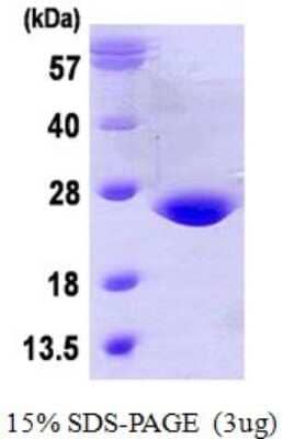 SDS-PAGE: Recombinant Human Glutathione Peroxidase 7 His Protein [NBP1-78890]