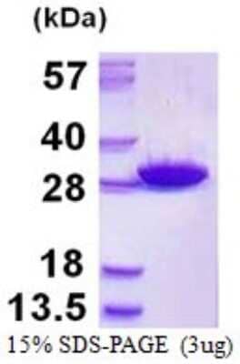 SDS-PAGE: Recombinant Human Glutathione S-transferase Mu 5 His Protein [NBP1-98932]