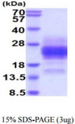 SDS-PAGE: Recombinant Human Glycophorin A His Protein [NBP2-59660]