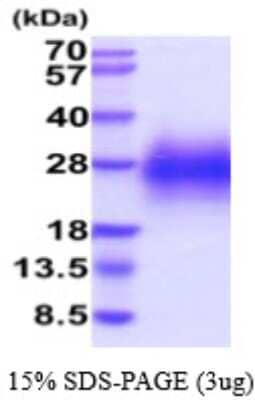 SDS-PAGE: Recombinant Human Glycophorin C His Protein [NBP2-59568]