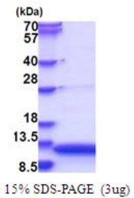 SDS-PAGE: Recombinant Human GnRH His Protein [NBP2-51724]