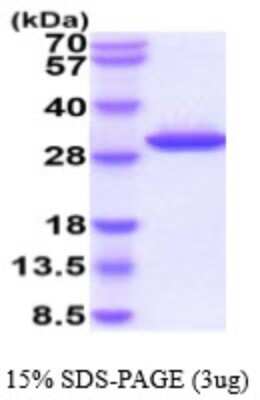 SDS-PAGE: Recombinant Human Granzyme K His Protein [NBP2-59561]