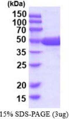 SDS-PAGE: Recombinant Human Guanine deaminase His Protein [NBP2-52618]