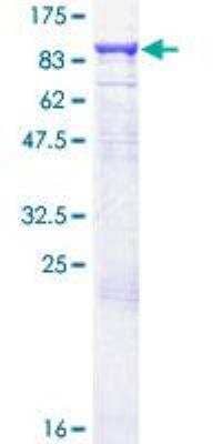 SDS-PAGE: Recombinant Human Guanylyl Cyclase alpha 1 GST (N-Term) Protein [H00002982-P01]