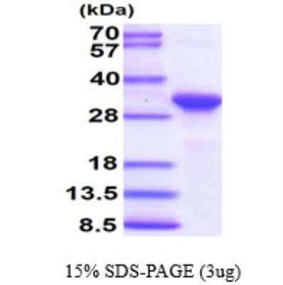 SDS-PAGE: Recombinant Human HABP1/C1QBP/GC1q R Protein [NBC1-18489]