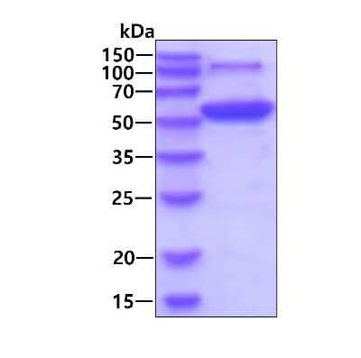 SDS-PAGE: Recombinant Human HARS His Protein [NBP1-48599]