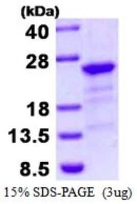 SDS-PAGE: Recombinant Human HBXIP His Protein [NBP1-98882]