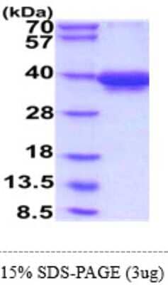 SDS-PAGE: Recombinant Human DAP10/HCST hIgG-His Protein [NBP2-61459]