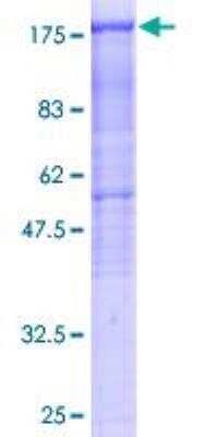 SDS-PAGE: Recombinant Human HDAC6 GST (N-Term) Protein [H00010013-P01]