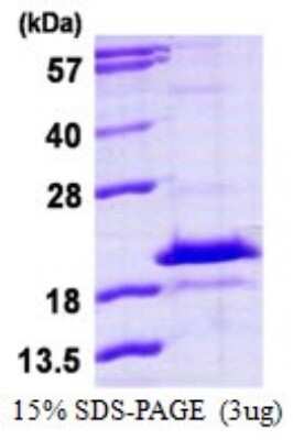 SDS-PAGE: Recombinant Human HDDC3 His Protein [NBP1-72506]