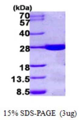 SDS-PAGE: Recombinant Human HDHD1A His Protein [NBP1-50883]