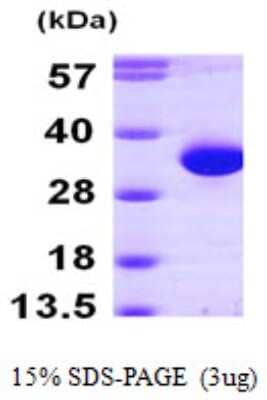 SDS-PAGE: Recombinant Human HDHD2 His Protein [NBP1-50902]