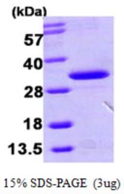 SDS-PAGE: Recombinant Human HDHD3 His Protein [NBP1-51017]