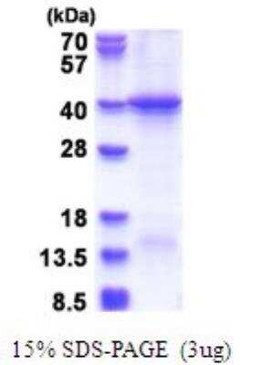 SDS-PAGE: Recombinant Human HERC5 His Protein [NBP2-51684]