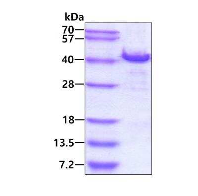 SDS-PAGE: Recombinant Human HHEX His Protein [NBP2-23108]