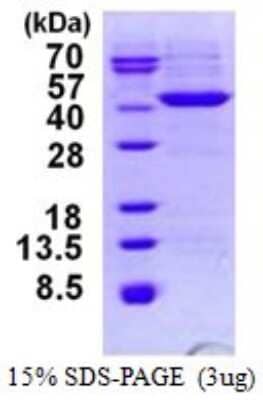 SDS-PAGE: Recombinant Human HIBCH His Protein [NBP1-99055]