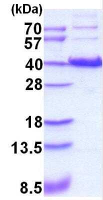 SDS-PAGE: Recombinant Human HIF-1 alpha Protein [NBC1-18422]