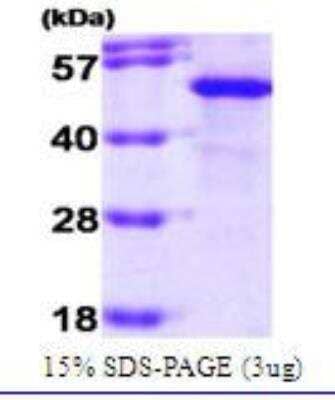 SDS-PAGE: Recombinant Human Hsp70 interacting protein HIP Protein [NBC1-19066]