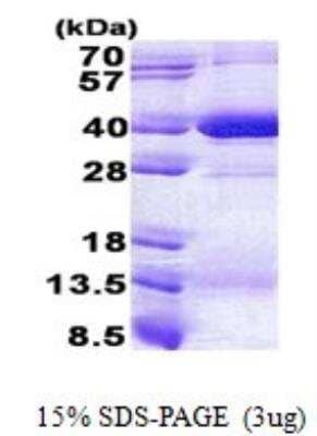 SDS-PAGE: Recombinant Human HLA C His Protein [NBP2-23210]