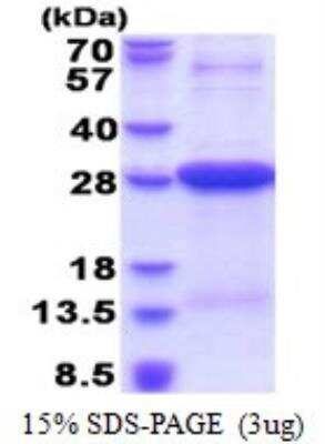 SDS-PAGE: Recombinant Human HLA DRA His Protein [NBP2-51601]