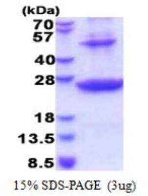 SDS-PAGE: Recombinant Human HLA DRB1 His Protein [NBP2-51599]