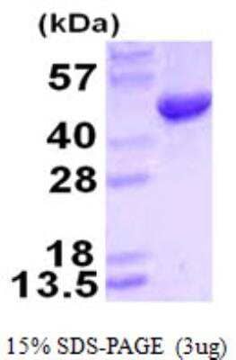 SDS-PAGE: Recombinant Human HMBS His Protein [NBP1-99086]