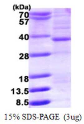 SDS-PAGE: Recombinant Human HMGCL His Protein [NBP1-78844]