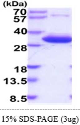 SDS-PAGE: Recombinant Human HMGCL His Protein [NBP2-60212]